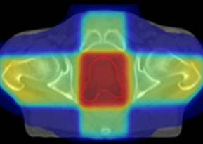 Example of older-style treatment